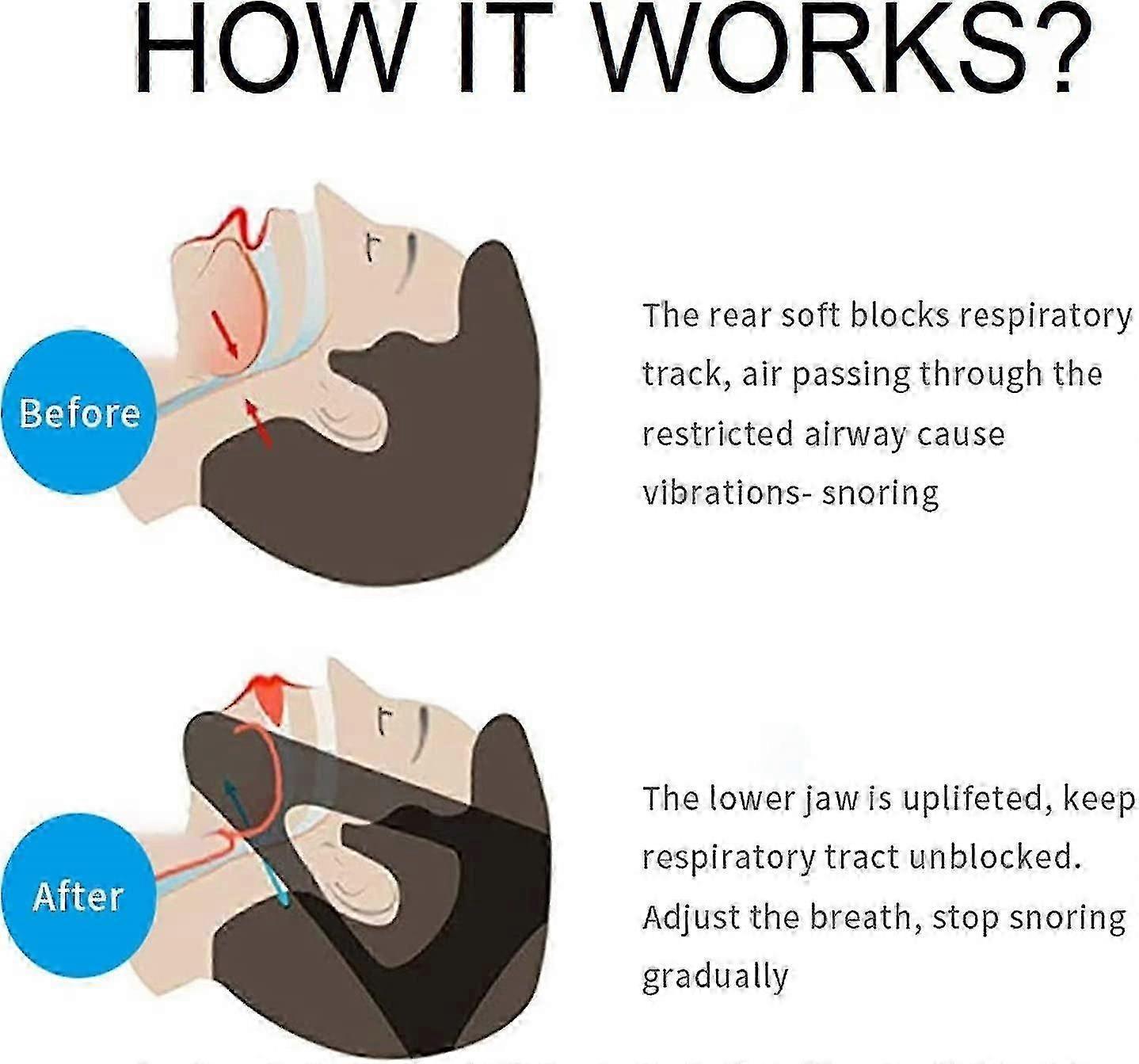 Anti Snoring Chin Strap, Upgrade Stop Snore Chin Strap, Snoring Solution Snore Stopper, Professional V1263-JX-3114