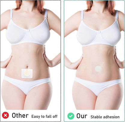20Pack Disposable Organic Castor Oil Pack Wrap for Belly Button - Clean and secure Alternat V1263-JX-3193