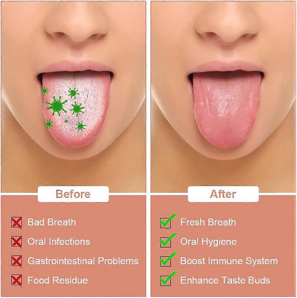 2PCS Stainless Steel Tongue Scrapers, Tongue Cleaner for Bad Breath - Silver V1263-JX-3882