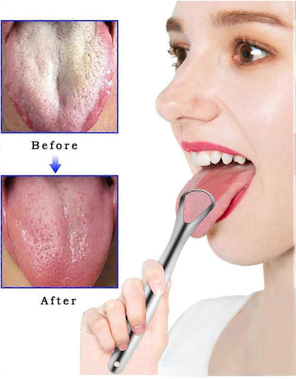3PCS Practical Stainless Tongue Scrapers, Metal Tongue Cleaner for Oral Hygiene V1263-JX-3891