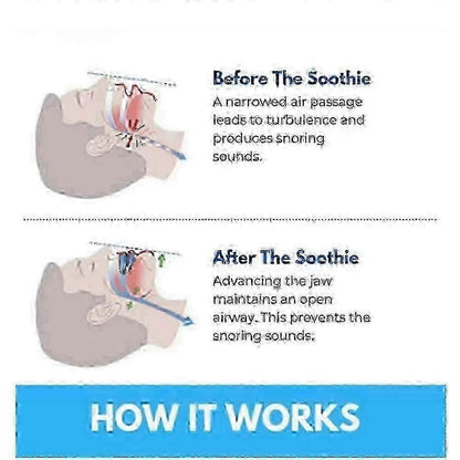 Honex Anti-Snoring Mouthpiece - Quite Night Device, Adjustable Jaw V1263-JX-6028