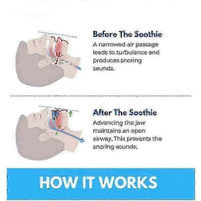 Honex Anti-Snoring Mouthpiece - Quite Night Device, PC+EVA V1263-JX-6029