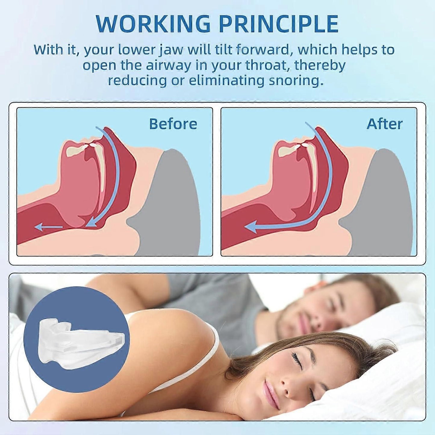 Anti-Snoring Mouthpiece - Reusable, FDA-Cleared, with Case V1263-JX-6032