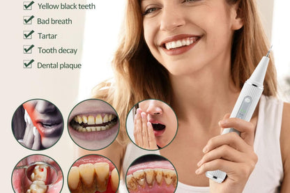 Teeth Cleaning Kit Plaque Remover Tartar Remover with 4 Replaceable Heads Rechargeable Teeth Cleaning Plaque V1263-JX-6531