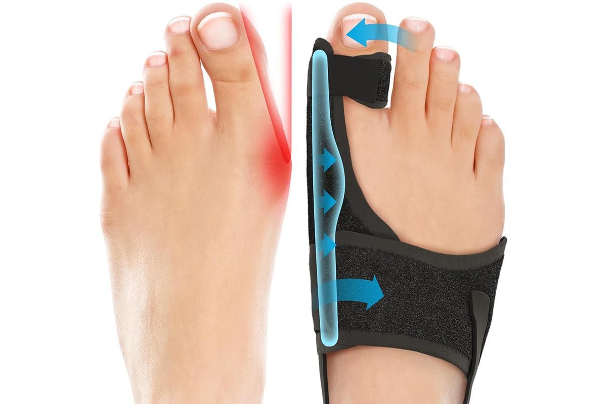 1 Pair Bunion Corrector Adjustable Length Orthopedic Toe Separator for Men and Women V1263-JX-6565