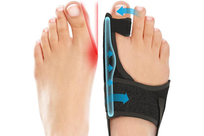 1 Pair Bunion Corrector Adjustable Length Orthopedic Toe Separator for Men and Women V1263-JX-6565