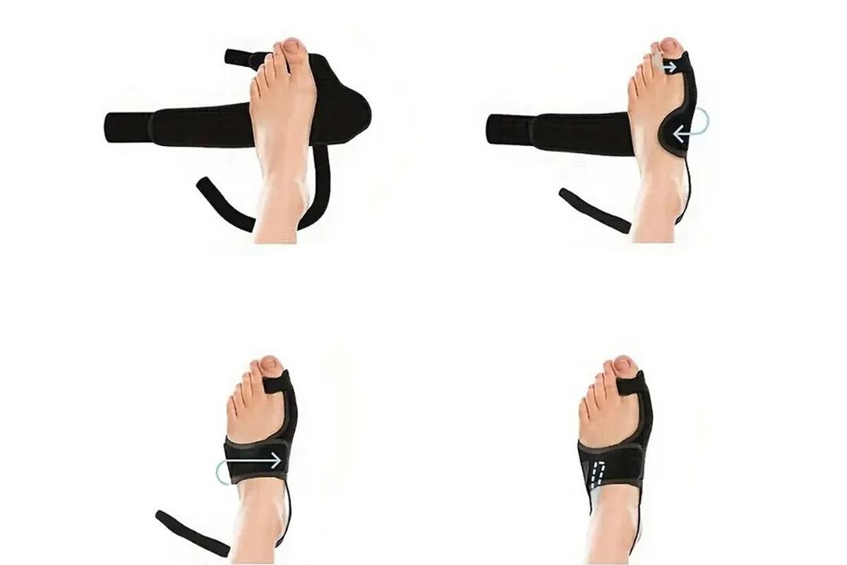 1 Pair Bunion Corrector Adjustable Length Orthopedic Toe Separator for Men and Women V1263-JX-6565