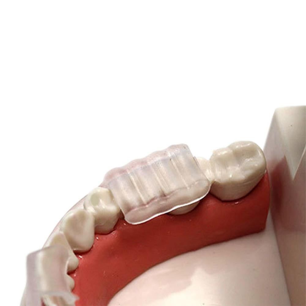 2pcs Anti Snore Mouth Guard Sleep Mouthguard Teeth Grinding Guard Dental Clenching Protector V1263-JX-7417