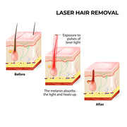 Silhouette Portable Laser Hair Remover Permanent Epliation System Body Face Home V160-351025