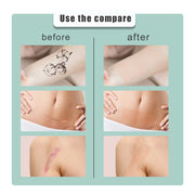 South moon Birthmark Skin Tone Concealer, Cover Body Scars Tattoo Spots Waterproof Color Masking Tape V201-W13194264