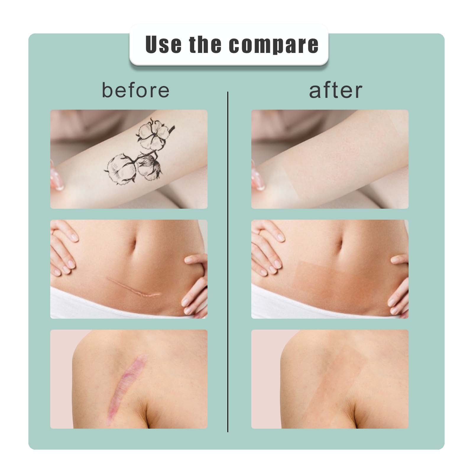 South moon Birthmark Skin Tone Concealer, Cover Body Scars Tattoo Spots Waterproof Color Masking Tape V201-W13194264