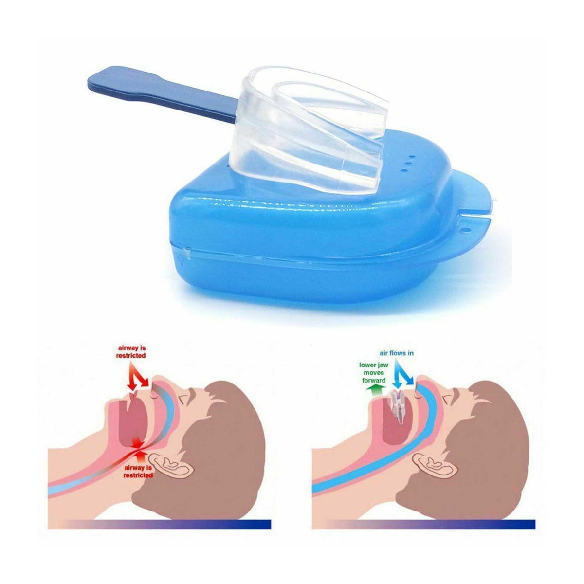 Anti Snoring Aid Mouth Guard - Adjustable Sleeping and Breathing Mouthguard V238-SUPDZ-16802510278