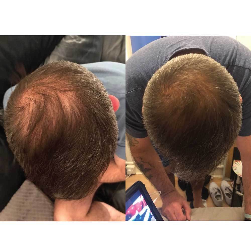 Watermans Grow Me Hair Growth Shampoo 250ml DHT Blocking Biotin Argan Anti Loss V238-SUPDZ-30407449018448