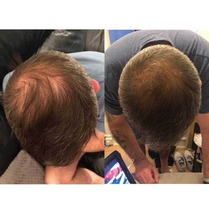 Watermans Grow Me Hair Growth Shampoo 250ml DHT Blocking Biotin Argan Anti Loss V238-SUPDZ-30407449018448