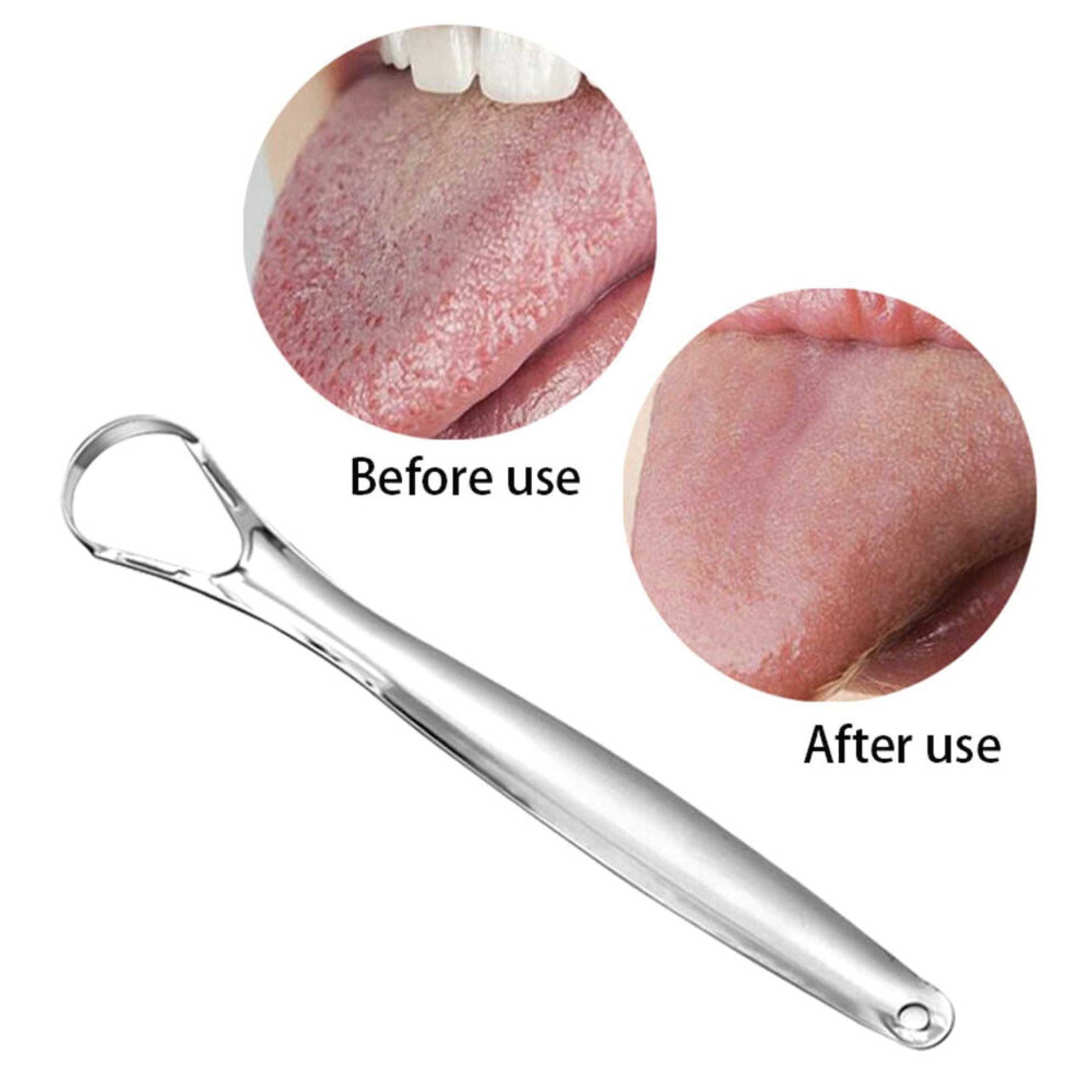 Stainless Steel Tongue Scraper Cleaner Oral Hygiene Reduce Bad Breath Metal Tool V238-SUPDZ-39514291208272