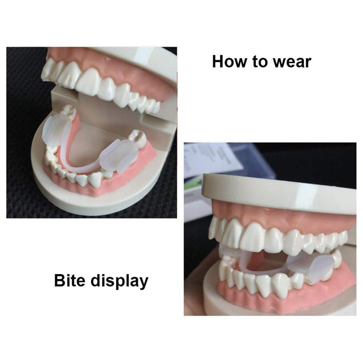Night Teeth Grinding Guard Men Women Sleep Relief Mouth Cushion Protector V528-BRACES-826423