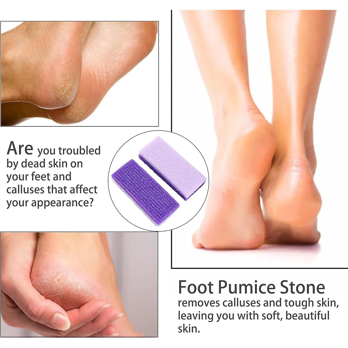 4X Pumice Foot Stone File Exfoliate Rasp Dead Skin Scrub Pedicure Remove Sands V528-FOOTRUBBINGSTONE-4PCS-31941