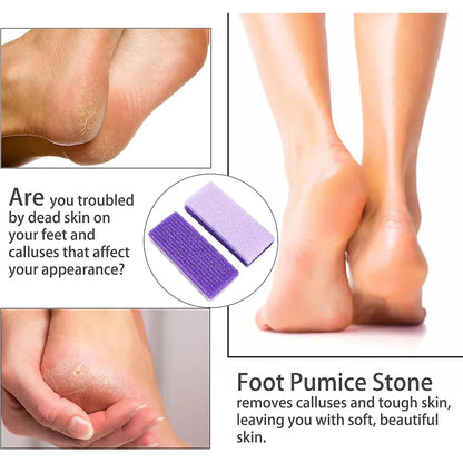 4X Pumice Foot Stone File Exfoliate Rasp Dead Skin Scrub Pedicure Remove Sands V528-FOOTRUBBINGSTONE-4PCS-31941