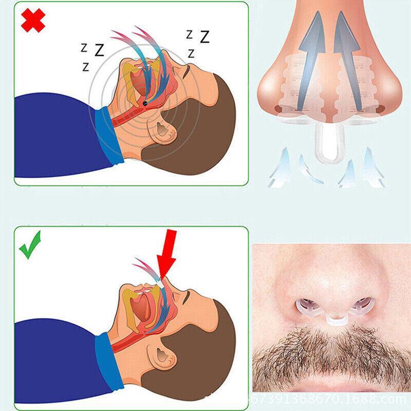 PE Nasal Vent Clip for Comfortable Breathing Airflow Support Accessory V528-NASALDILATOR-1PCS-270877