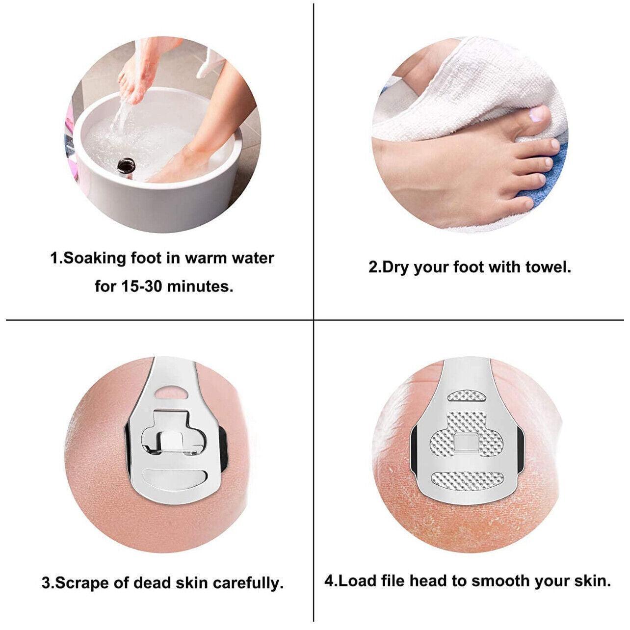 Foot File Hard Skin Remover Callus Shaver Corn Cutter Tool Pedicure + 10 Blades V528-PACKAGE-SRCUBBER10BLADES76986