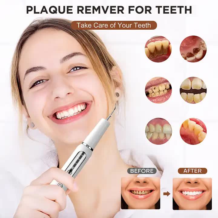 White Portable Ultrasonic Dental Cleaner, Home Use Plaque Remover, Sonic Tooth Stain & Tartar Cleaning Tool V888-ELOSUNG13323