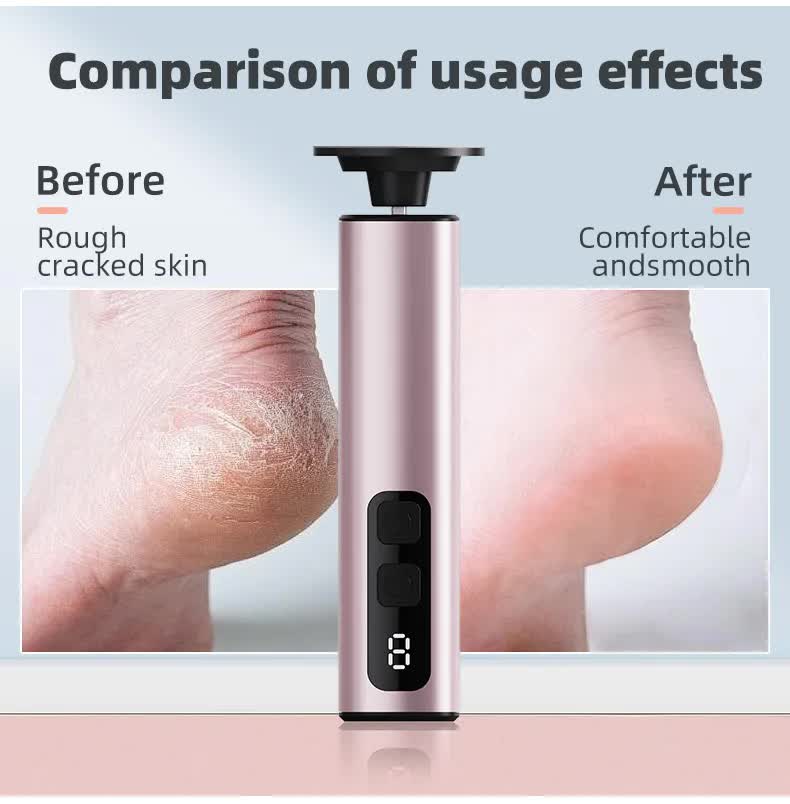 Purple Rechargeable Electric Foot File with 9 Speed Settings - Callus Remover for Smooth Feet V888-ELOSUNG23517