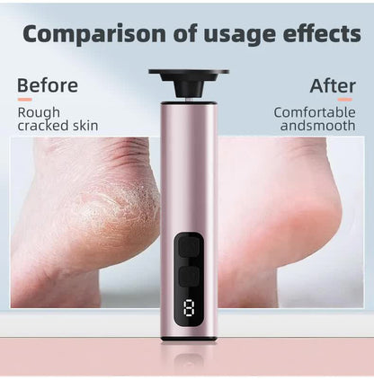 Purple Rechargeable Electric Foot File with 9 Speed Settings - Callus Remover for Smooth Feet V888-ELOSUNG23517