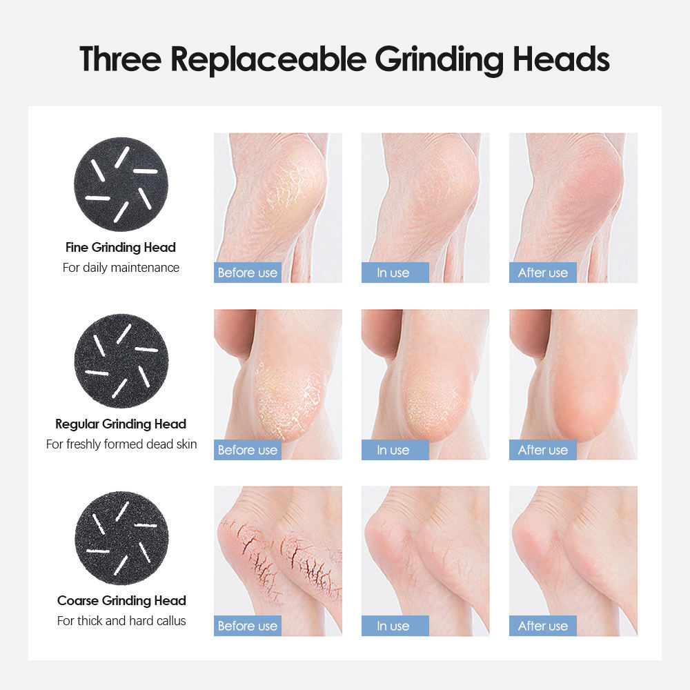 Black Rechargeable Electric Foot Grinder with Suction - Complete 10-Piece Pedicure Kit V888-ELOSUNG26741