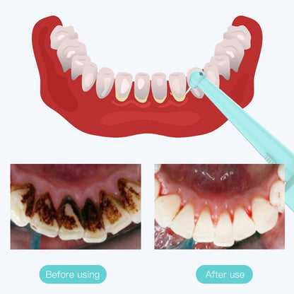 Intelligent High-Frequency Vibration Dental Calculus & Stain Remover(pink) V888-ELOSUNG29666