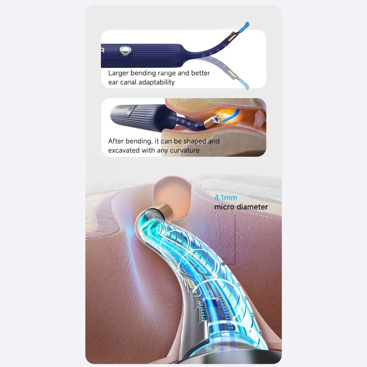 Smart Visual Ear Cleaner with HD Endoscope & Precision Tweezers - Safe for Adults & Children(blue) V888-ELOSUNG29686
