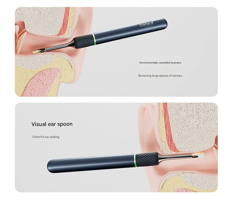 Smart Visual Ear Cleaner with HD Endoscope & Precision Tweezers - Safe for Adults & Children(White) V888-ELOSUNG29690