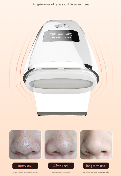 White Professional 4-in-1 Ultrasonic Skin Scrubber - Deep Pore Cleanser, Blackhead Remover & EMS Facial V888-ELOSUNG32930