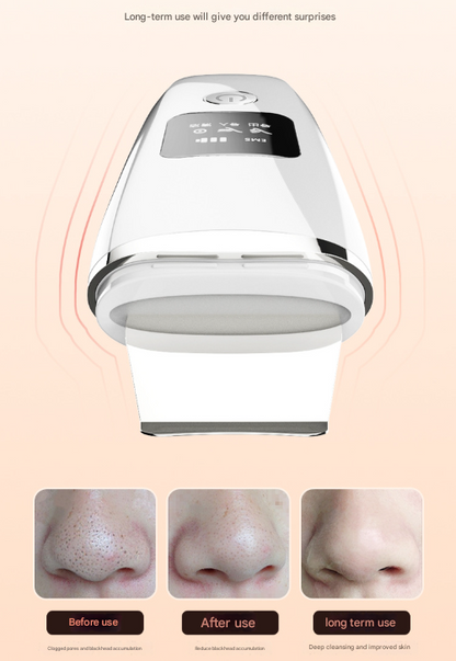 White Professional 4-in-1 Ultrasonic Skin Scrubber - Deep Pore Cleanser, Blackhead Remover & EMS Facial V888-ELOSUNG32930