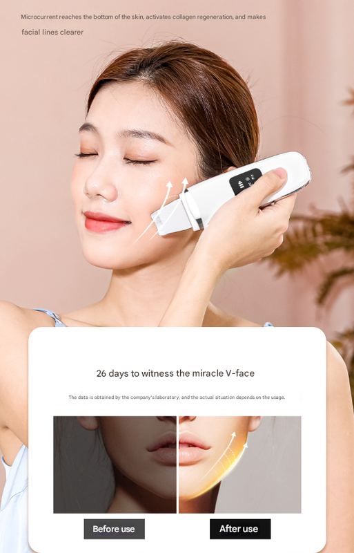 White Professional 4-in-1 Ultrasonic Skin Scrubber - Deep Pore Cleanser, Blackhead Remover & EMS Facial V888-ELOSUNG32930