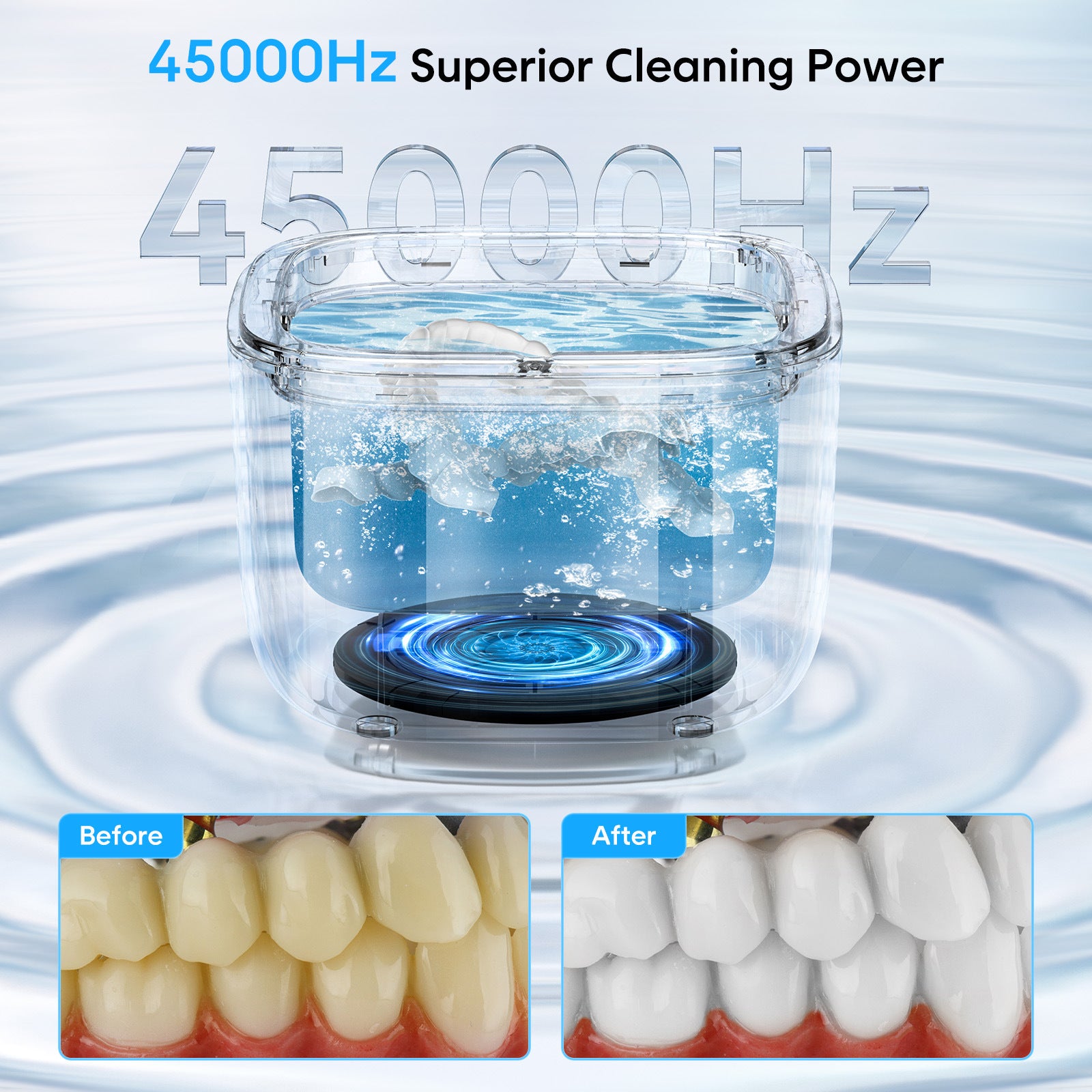 Professional Ultrasonic Cleaner with UV Light - 45000Hz for Dentures, Retainers, Jewelry & More(black) V888-ELOSUNG35621