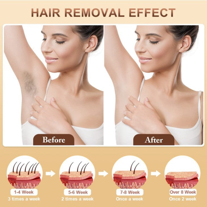 IPL Hair Removal Device - 3-in-1 Permanent Hair Reduction, Skin Rejuvenation & Acne Control(white) V888-ELOSUNG35680
