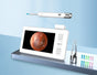 All-in-One Wireless Visual Ear Cleaner Kit with 4.3" IPS Display Screen(white) V888-ELOSUNG35839