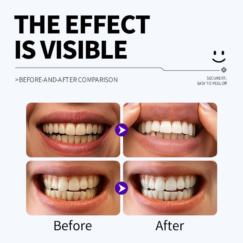 Professional Enamel-Safe Teeth Whitening Strips(12 Strips per Pack) - Antibacterial Gum Care & Deep Cleaning V888-ELOSUNG45221