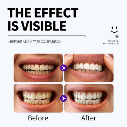 Professional Enamel-Safe Teeth Whitening Strips(12 Strips per Pack) - Antibacterial Gum Care & Deep Cleaning V888-ELOSUNG45221