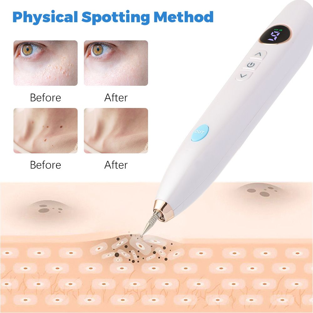 White USB Powered Physical Mole Removal Pen with LCD Display, 7 Needles & 9-Levels Adjustable Intensity - V888-ELOSUNG49919