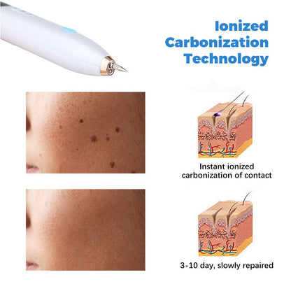 White USB Powered Physical Mole Removal Pen with LCD Display, 7 Needles & 9-Levels Adjustable Intensity - V888-ELOSUNG49919