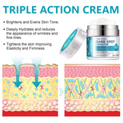 Age Spot Cream | Fades Freckles & Skin Pigmentation | Dark Spot Corrector for Even Skin Tone V932-53-MG3T-BJ6G