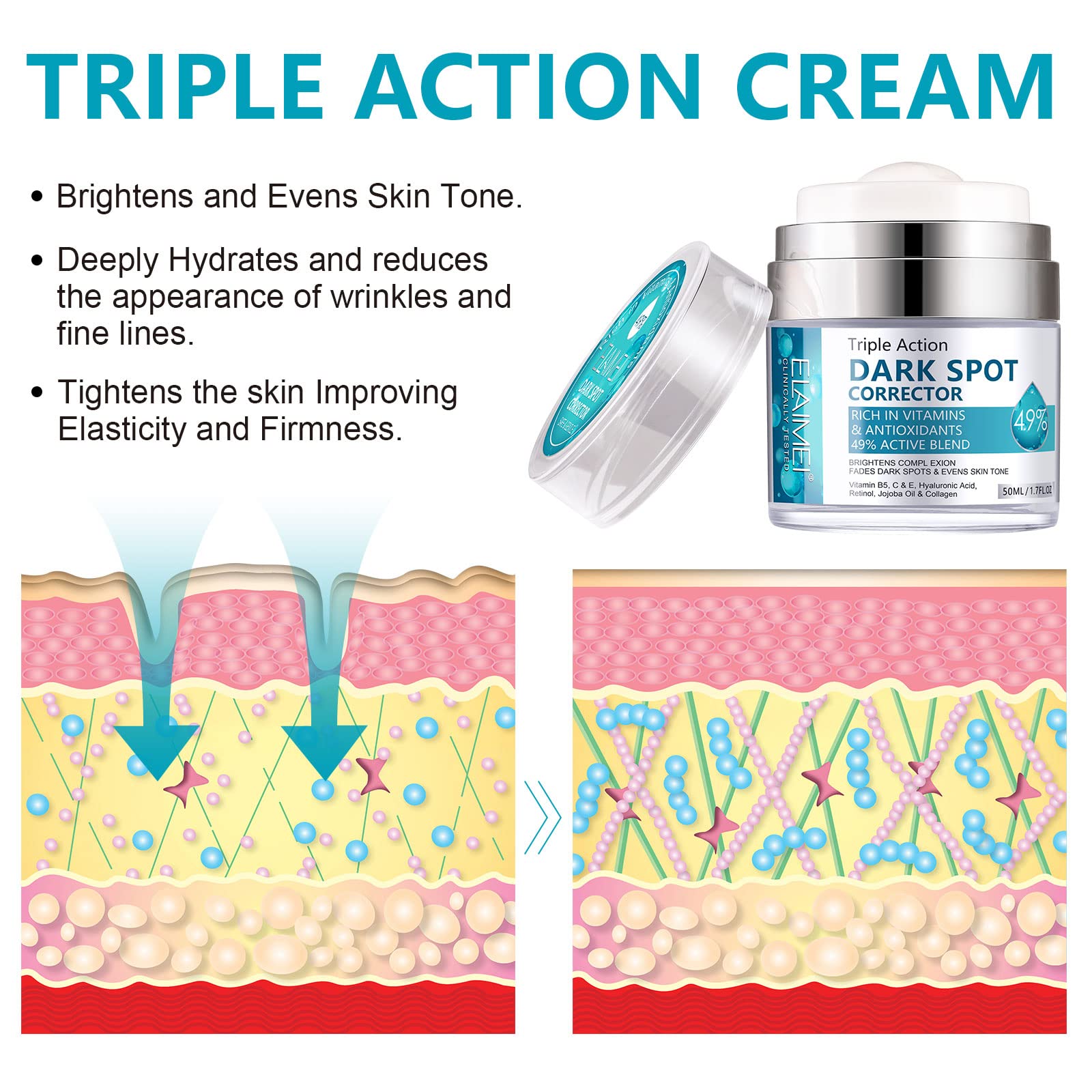 Age Spot Cream | Fades Freckles & Skin Pigmentation | Dark Spot Corrector for Even Skin Tone V932-53-MG3T-BJ6G