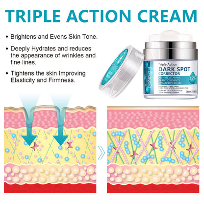 Age Spot Cream | Fades Freckles & Skin Pigmentation | Dark Spot Corrector for Even Skin Tone V932-53-MG3T-BJ6G