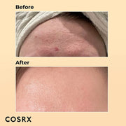 COSRX Advanced Snail 96 Mucin Power Essence - 100ml V932-SNAIL96