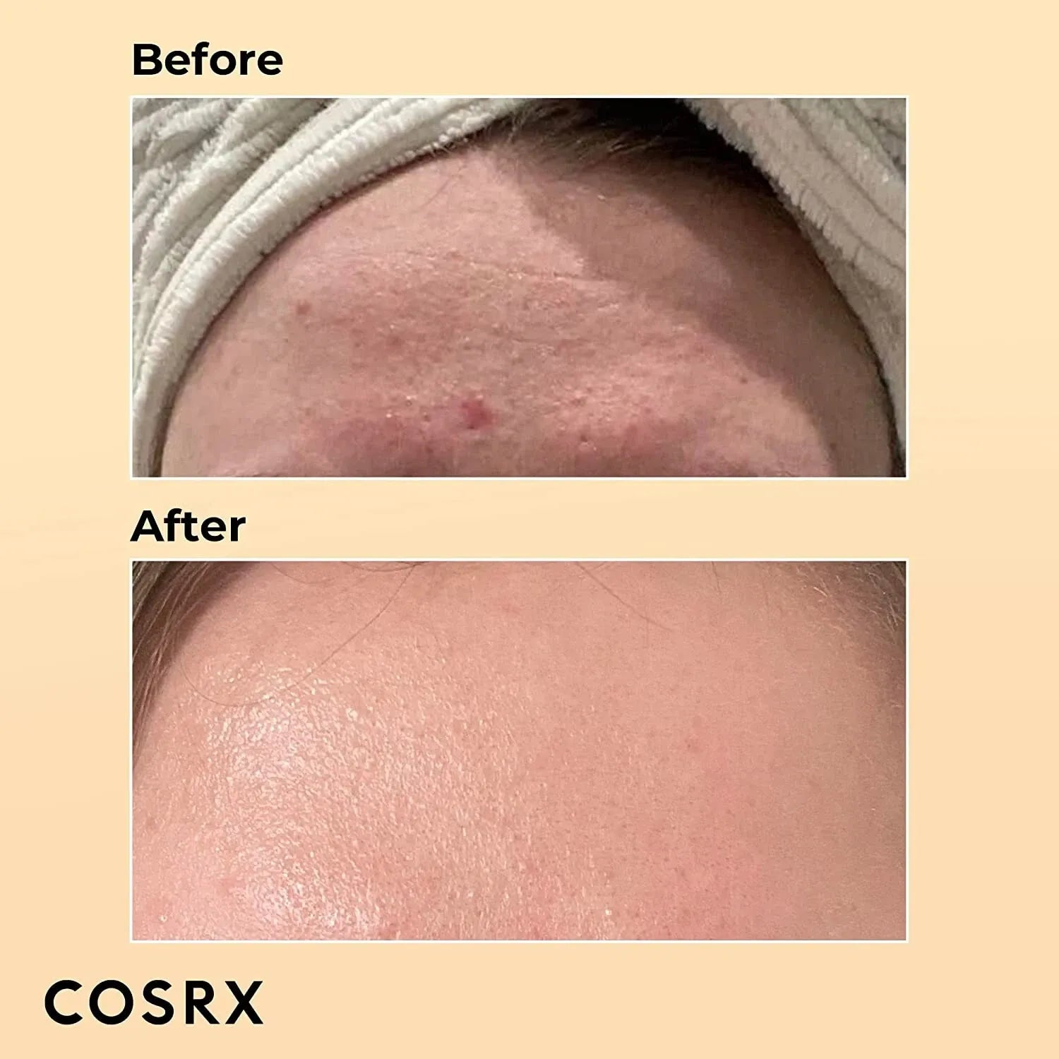 COSRX Advanced Snail 96 Mucin Power Essence - 100ml V932-SNAIL96