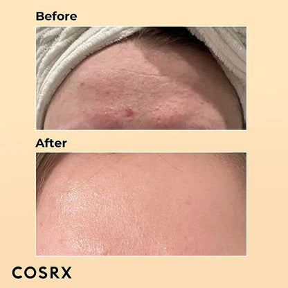 COSRX Advanced Snail 96 Mucin Power Essence - 100ml V932-SNAIL96