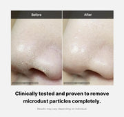 MEDICUBE Zero Foam Cleanser 120g - Deep Cleansing, Pore Care - AU Seller V932-ZEROCLEANER